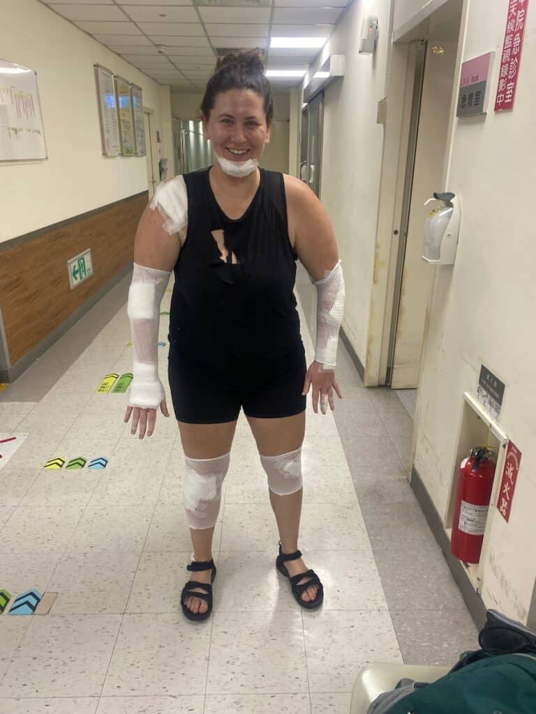 Photo of a woman laughing while showing her heavily bandaged leg, seated beside her friend, capturing a moment of light-heartedness after a biking accident.